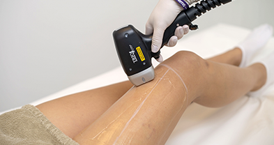 Facial Laser Hair Removal